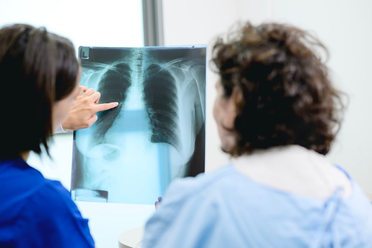 In Ireland, around 60 per cent of people diagnosed with lung cancer are detected at a later stage, when treatment options are more limited - stock photo