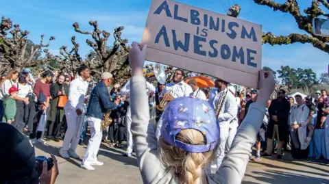 Heidi Alletzhauser/California Academy of Sciences Press Office A little girl holding up a sign that says "albinism is awesome" in front of a crowd of people