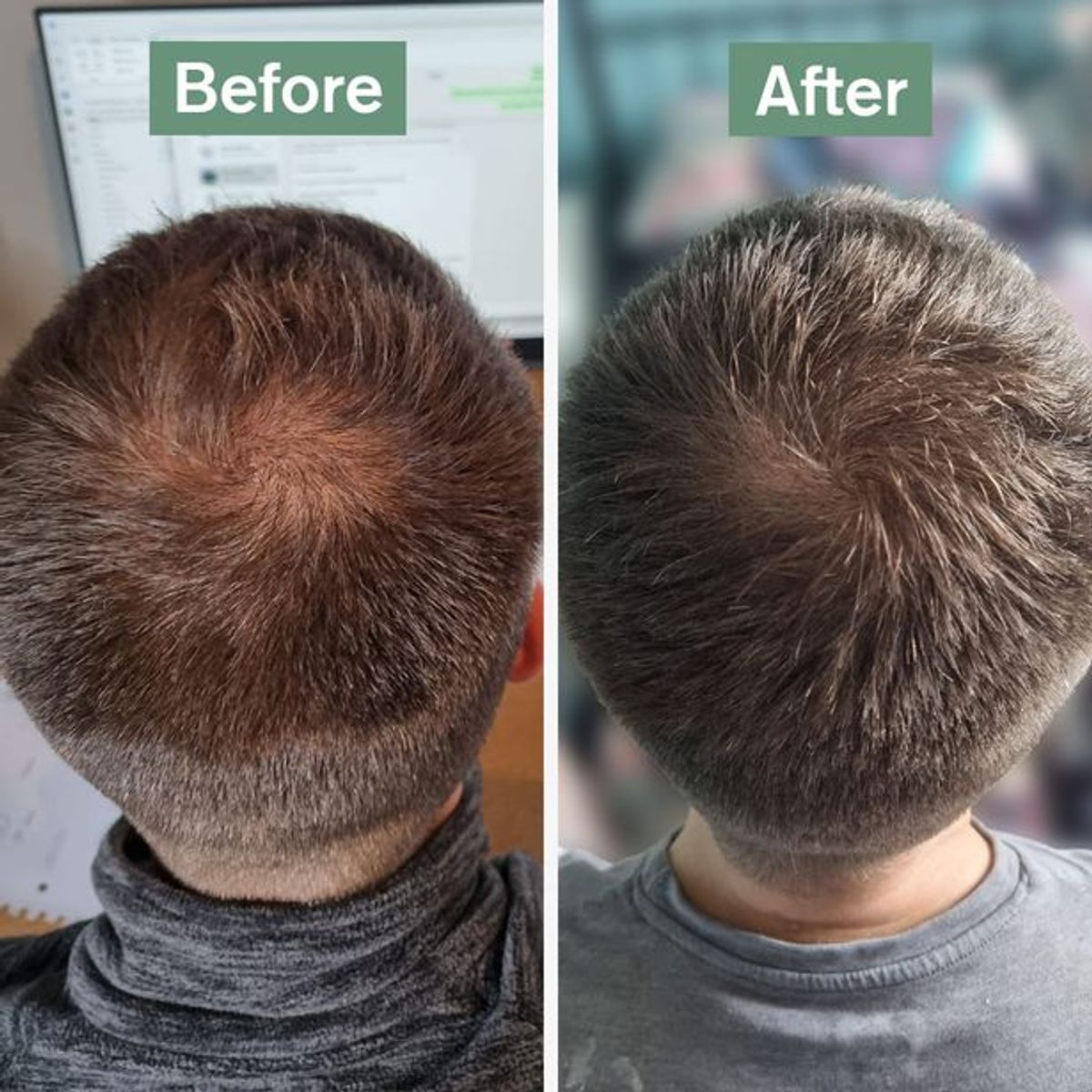 James, a Hair Saviour customer, shares his before and after results