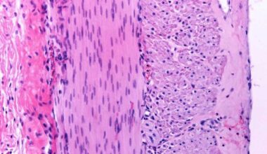 Microscope image of muscular layer of the small intestine with of two layers of smooth muscle fibers.