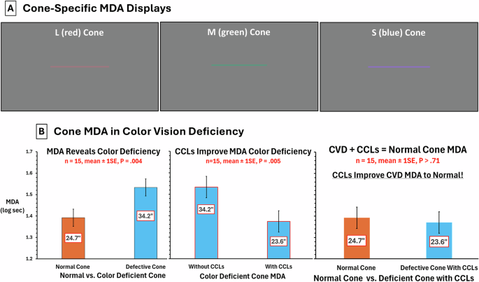 Minimum detectable acuity: Diagnosis of colour deficiency and improvement with colour correcting lenses