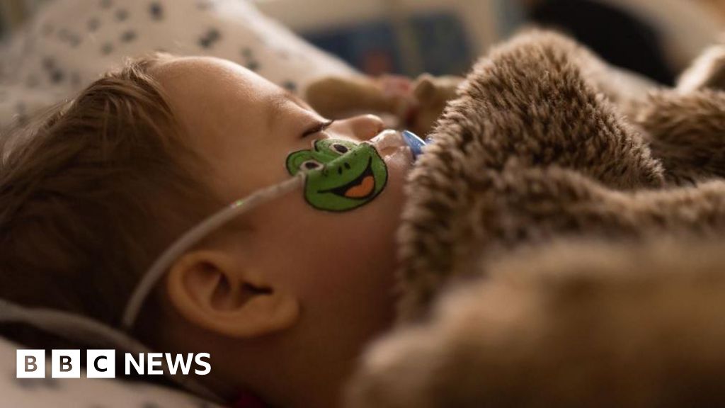 Surge in children with respiratory virus in Hull