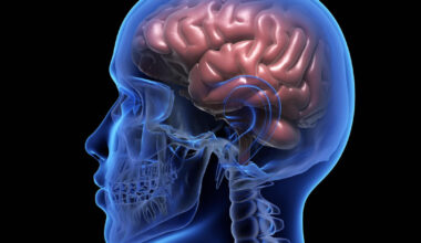 Scientists develop 'unique' AI-powered headset that can predict epileptic seizures before they occur