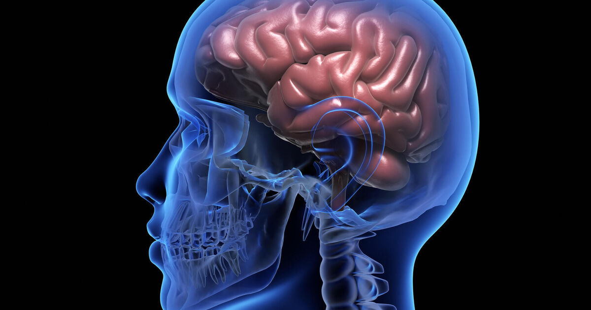 Scientists develop 'unique' AI-powered headset that can predict epileptic seizures before they occur