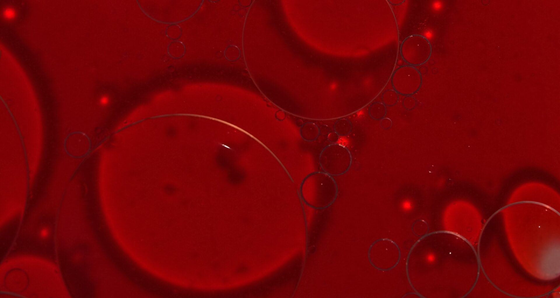 Small shifts in blood sodium may influence human brain excitability