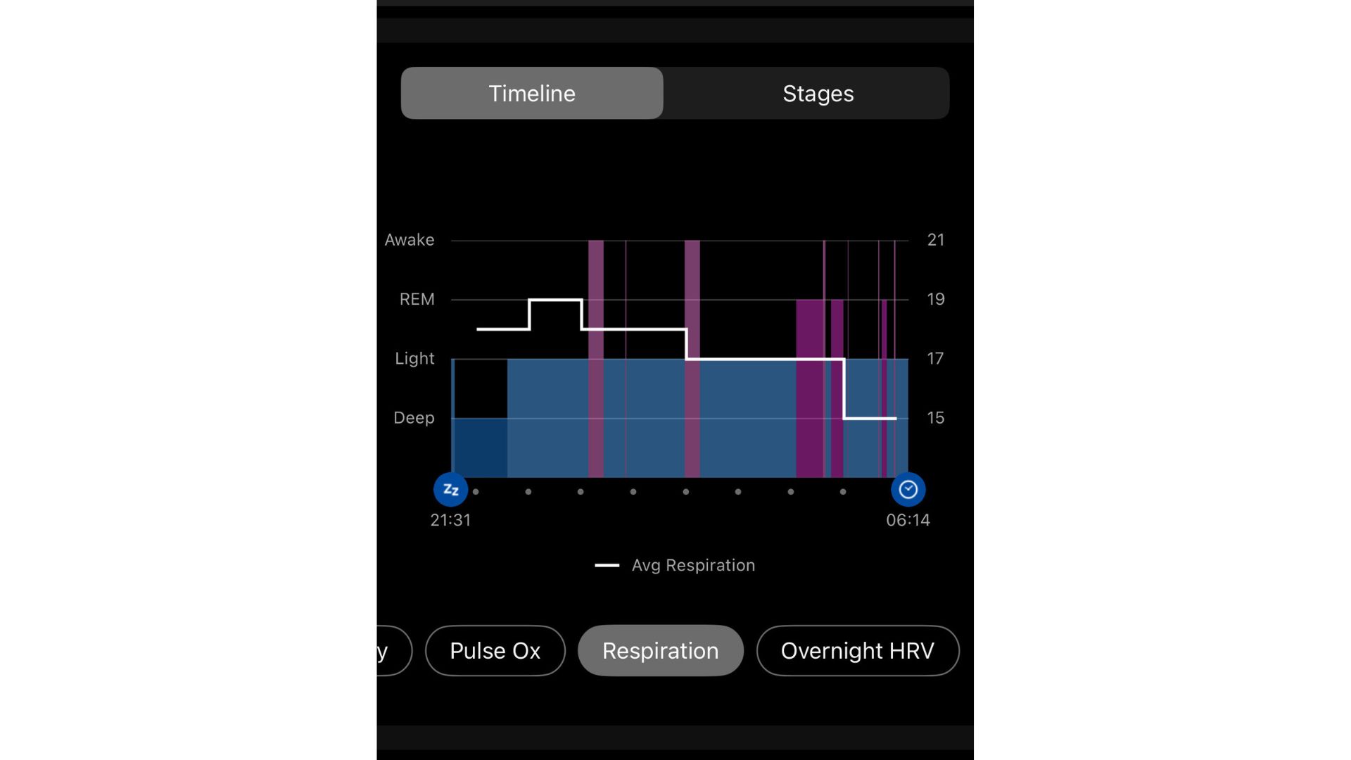 Screenshots of Garmin Connect app interface showing sleep and stress stats