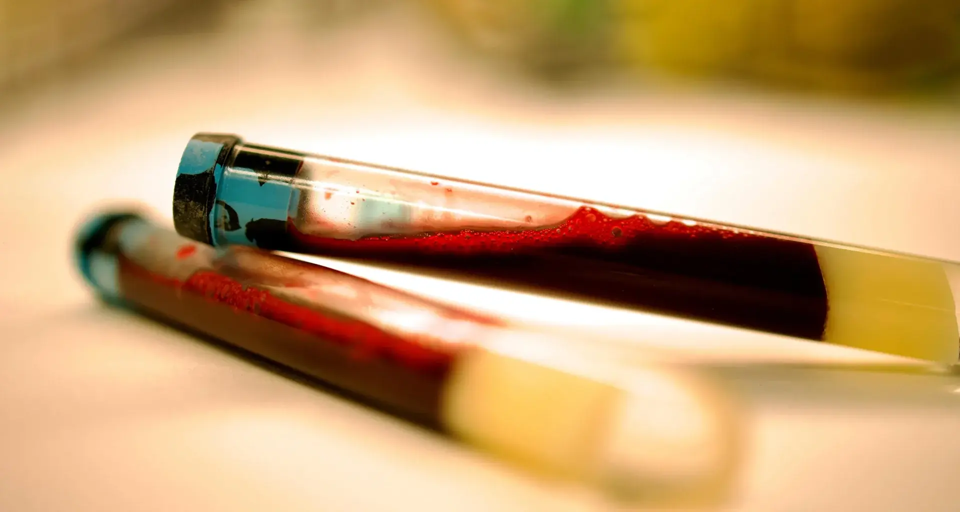 A simple blood test could spot Parkinson’s years before symptoms
