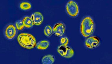 Dangerous, drug-resistant fungus spreads across N.Y., N.J. hospitals and nursing homes