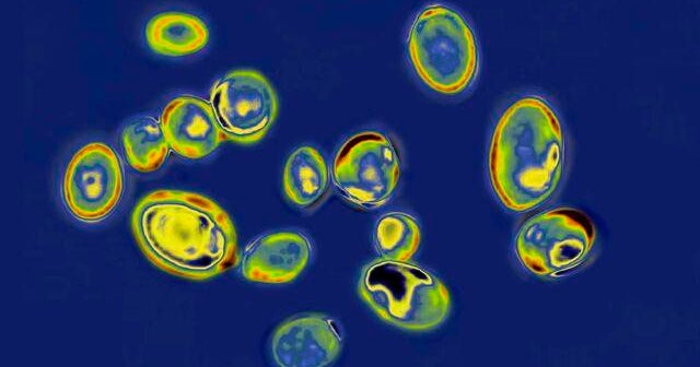 Dangerous, drug-resistant fungus spreads across N.Y., N.J. hospitals and nursing homes