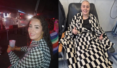 ‘A doctor laughed when I suggested my symptoms were cancer – then I got my Hodgkin lymphoma diagnosis at 24’