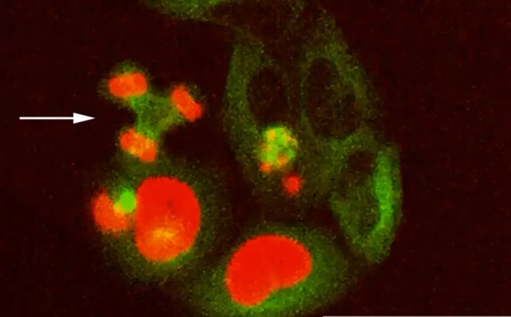 Scientists find a DNA repair glitch that pushes aging into fast-forward