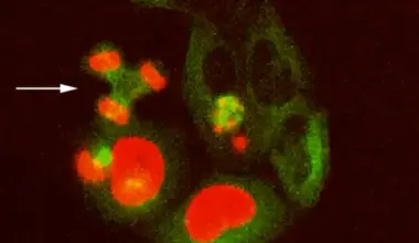 Scientists find a DNA repair glitch that pushes aging into fast-forward