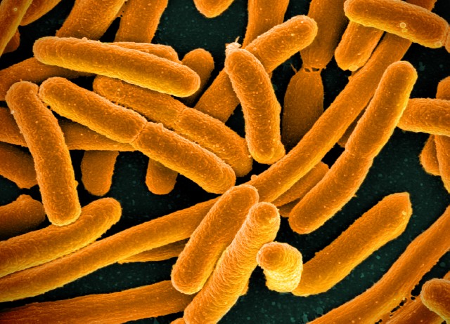 An image of E. coli bacteria under the microscope.