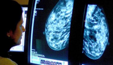 Mammograms currently need two radiologists to assess the results. Pic: PA