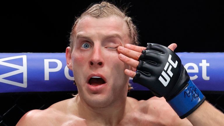 Paddy Pimblett, UFC (Associated Press)