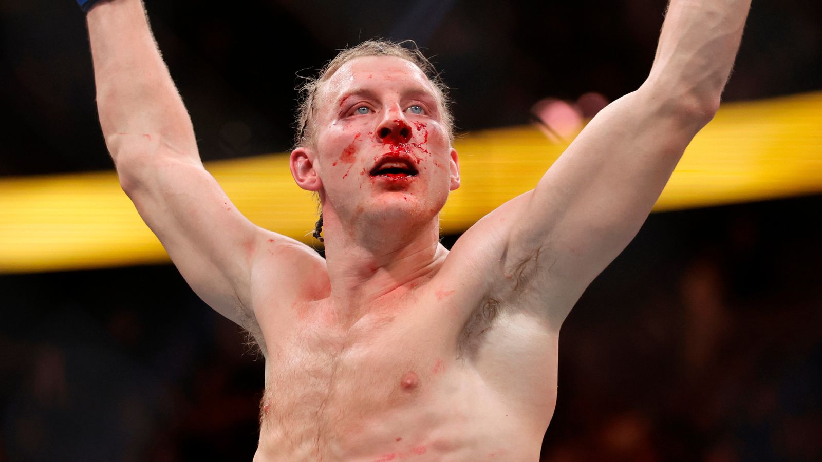 Paddy Pimblett, UFC (Associated Press)