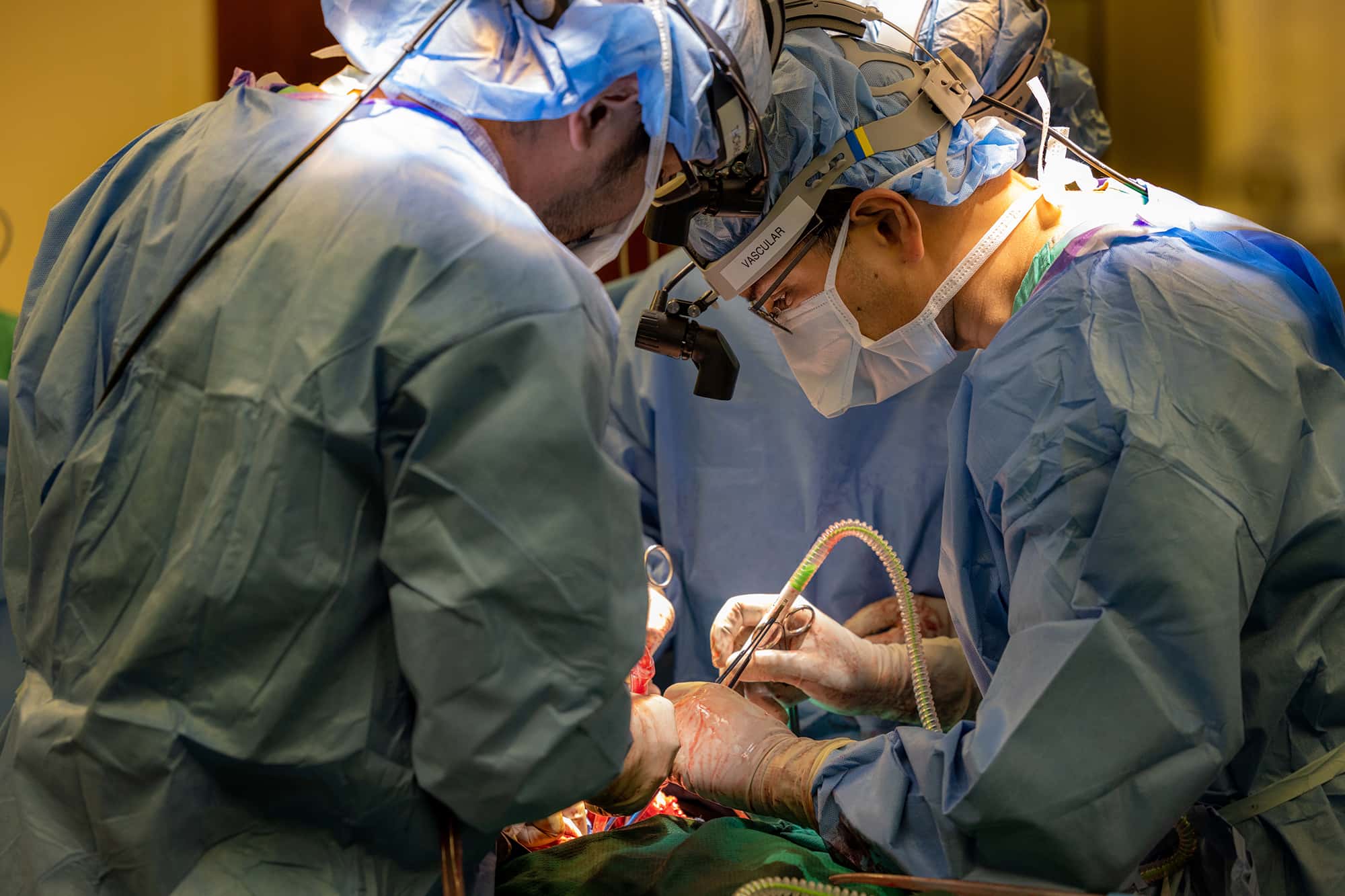 total artificial lung system during double-lung transplant