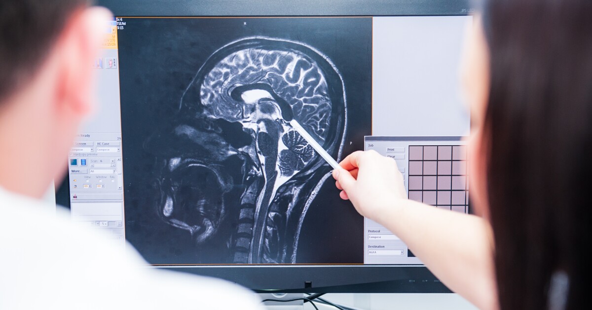 UVA researchers find link between head injuries and Alzheimer's risk — and a possible way to reduce it