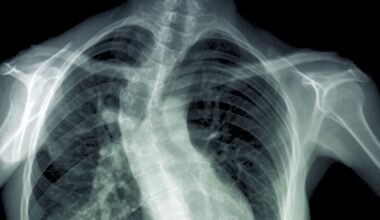 Legal issues around publishing spinal report