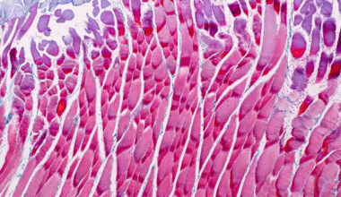 Scientists identify regenerative checkpoint that limits muscle repair