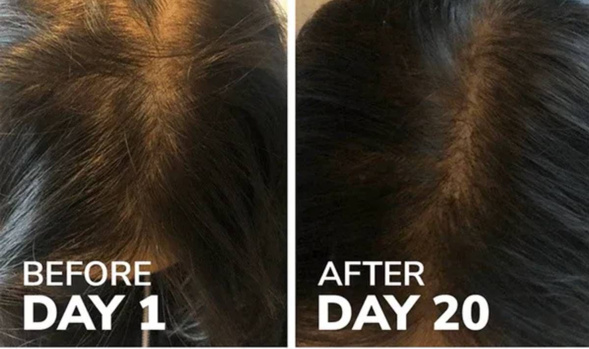 Reverse Life's collagen helps with thinning hair as well as weakened nails and wrinkled skin