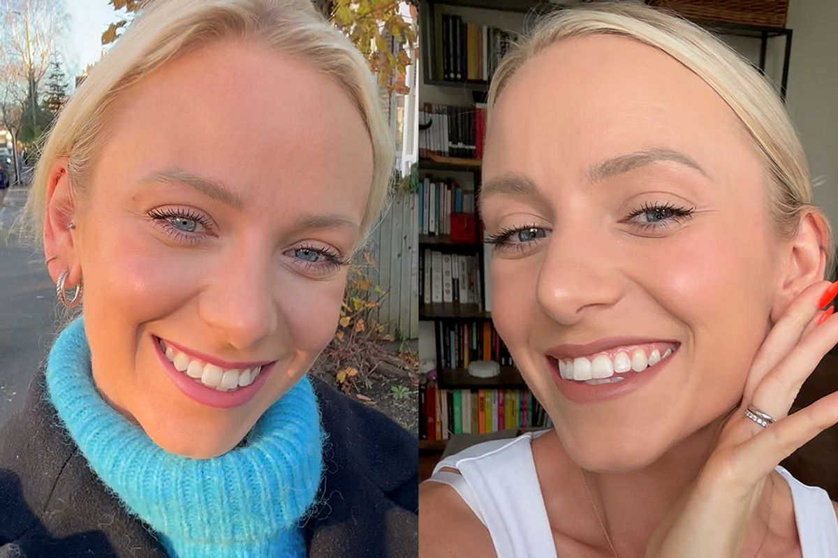 A customer before and after using MySweetSmile.