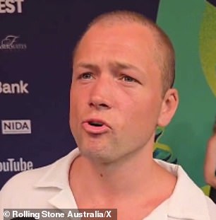 The actor's humility was subsequently praised by fans after the exchange was posted on social media, but others were more preoccupied with Egerton's lack of hair