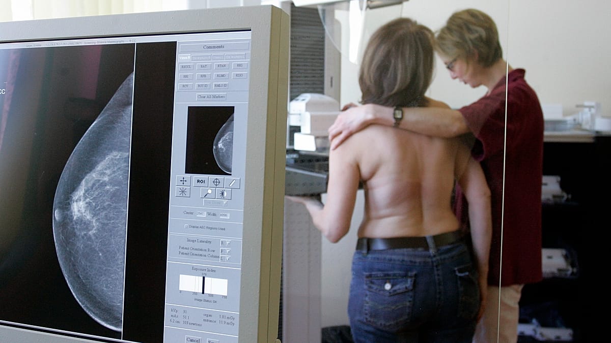 AI may help detect aggressive breast cancers earlier, researchers say