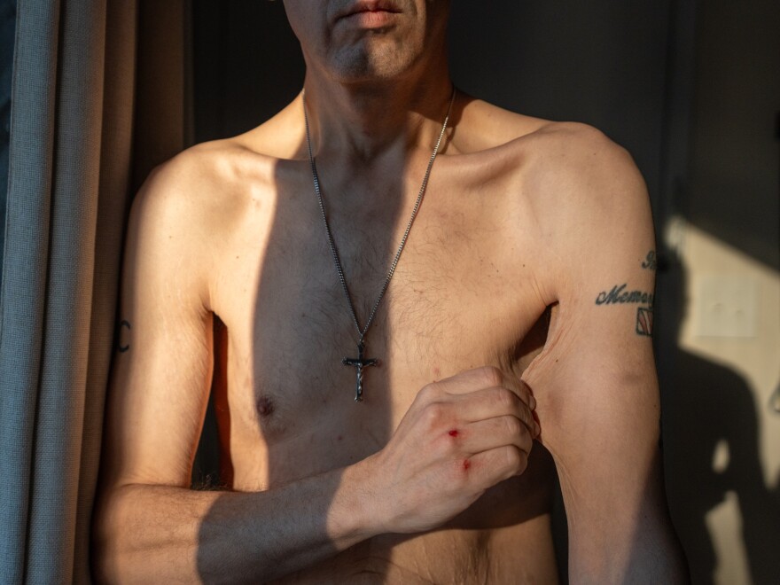 Jason Krynicki has grappled with body dysmorphia. He still has feelings of being too overweight.