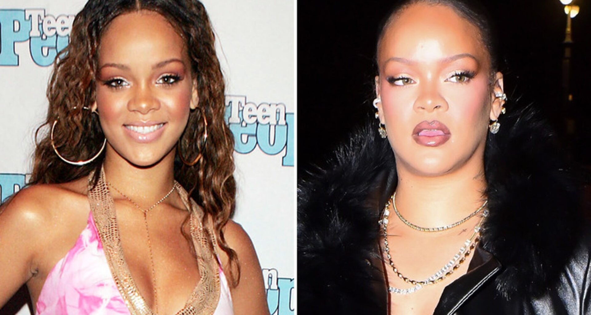 Rihanna Good Genes or Good Docs?!