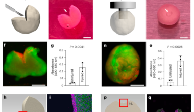 Injury and therapy in a human spinal cord organoid