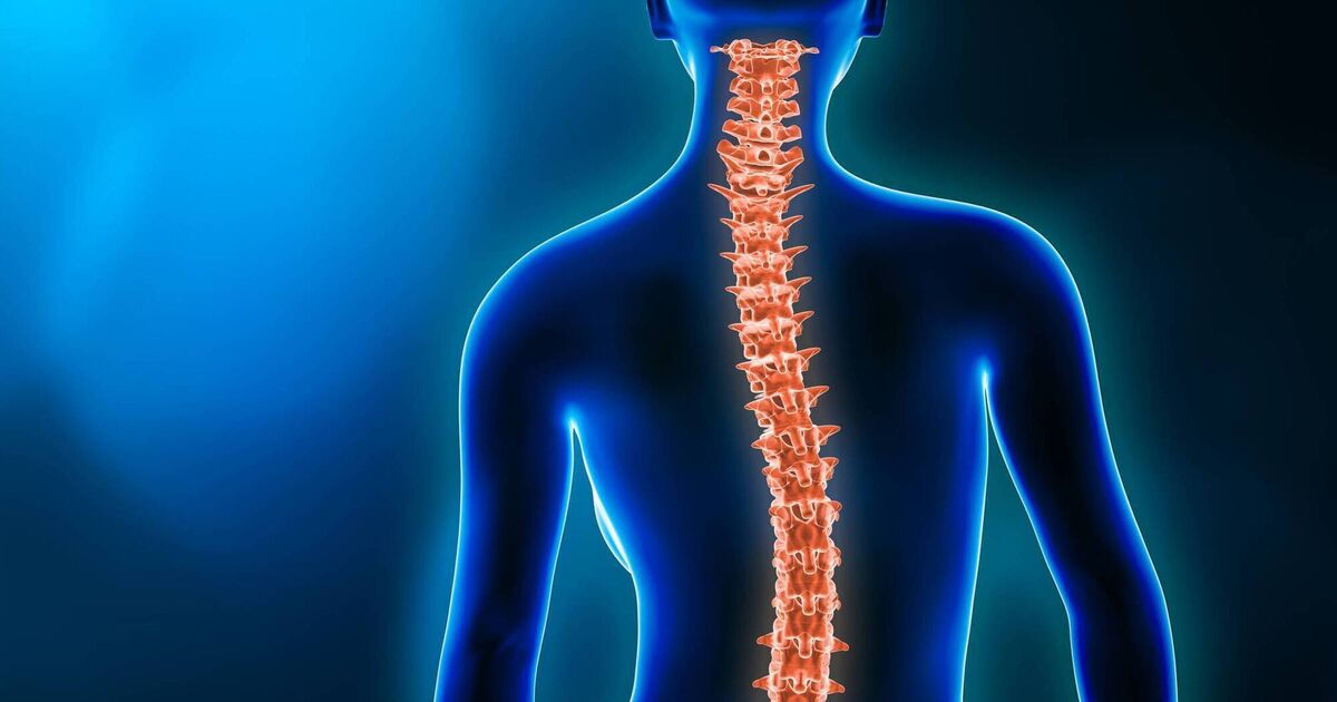 Cork children waiting more than four months for first scoliosis appointment