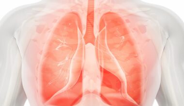 Early Time-of-Day Chemoimmunotherapy Boosts Survival in NSCLC