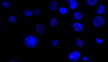 Crick spin‑out ALTx will target cancer cell immortality