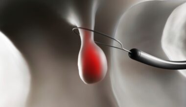 A standard practice for colonoscopy completion