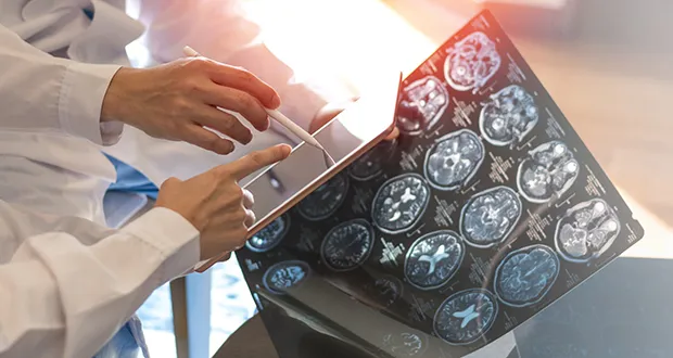 multiple sclerosis MS