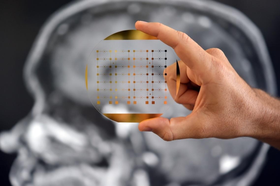 Researchers open ‘window to the brain’ with powerful cancer tech