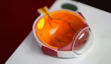 Study: Metformin and incidence of age-related macular degeneration in people with diabetes: a population-based 5-year case-control study. Image Credit: reddees / Shutterstock