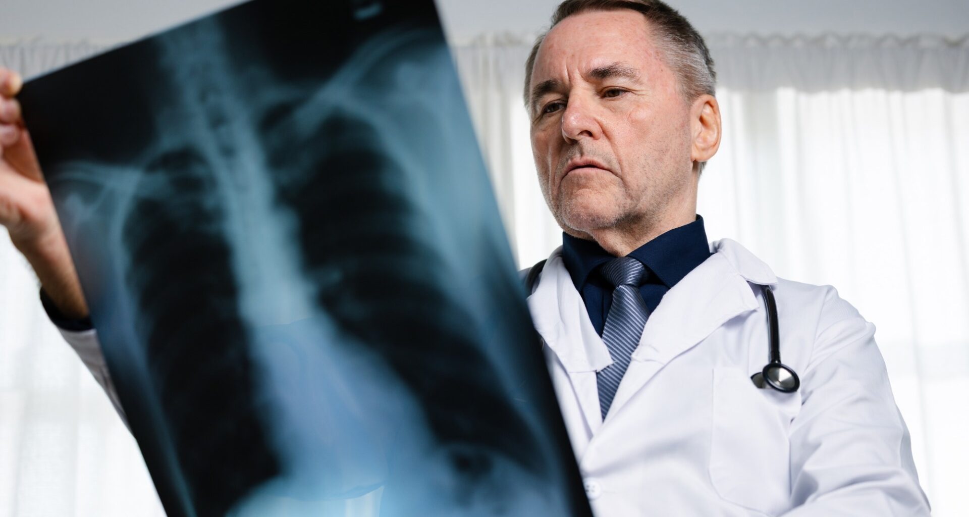 Opinion: Lung cancer in never smokers: from early detection to prevention. Image Credit: Thx4Stock team / Shutterstock