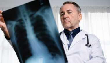 Opinion: Lung cancer in never smokers: from early detection to prevention. Image Credit: Thx4Stock team / Shutterstock