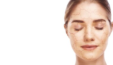 Dry skin linked to systemic lipid imbalance, not simple deficiency