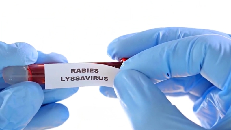 Gloved hands holding a test tube labeled Rabies Lyssavirus