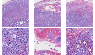 Immune conflict in placenta affects male fetal development