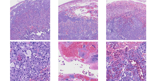 Immune conflict in placenta affects male fetal development