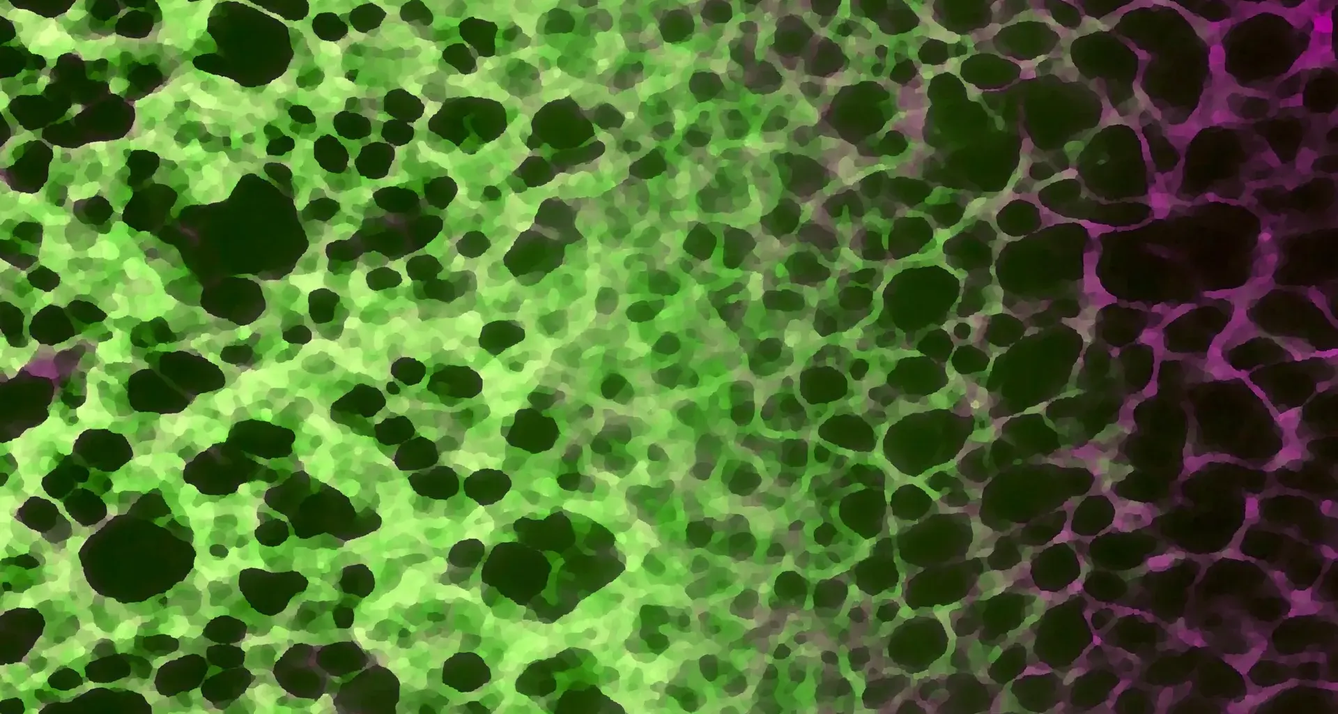 A hidden cellular process may drive aging and disease