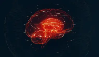 AI reads brain MRIs in seconds and flags emergencies
