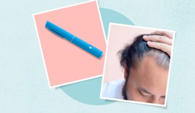 GLP-1s May Cause Hair Thinning in the First Year — But It’s Likely Temporary
