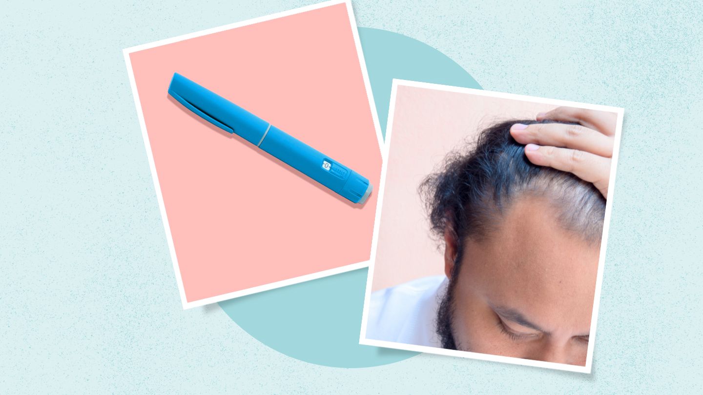 GLP-1s May Cause Hair Thinning in the First Year — But It’s Likely Temporary