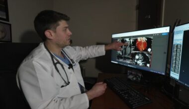 Doctors using AI for clearer picture during heart screenings – NBC10 Philadelphia