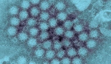 Public urged to be alert to signs and symptoms of norovirus as cases up over 50% in a week - The Journal